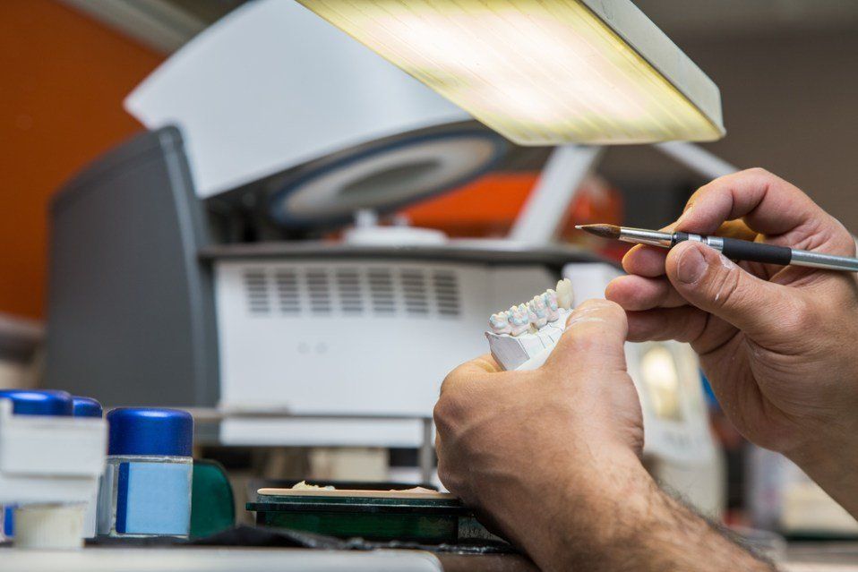 Impronta per realizzazione protesi