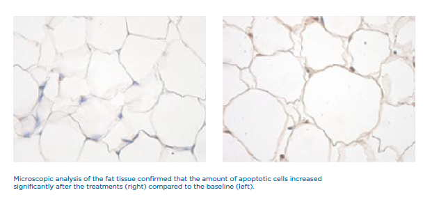 Muscle Build — Microscopic View Of Fat Tissue in Columbus, OH