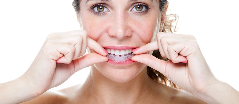 A woman is holding a clear brace in her mouth.