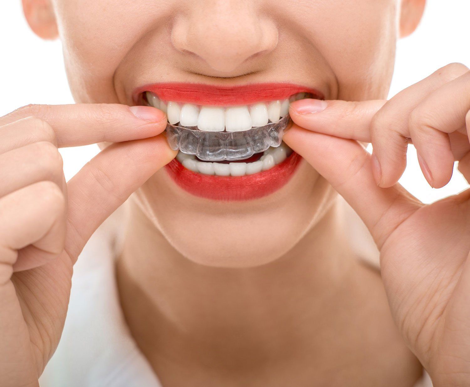 woman putting in mouthguard