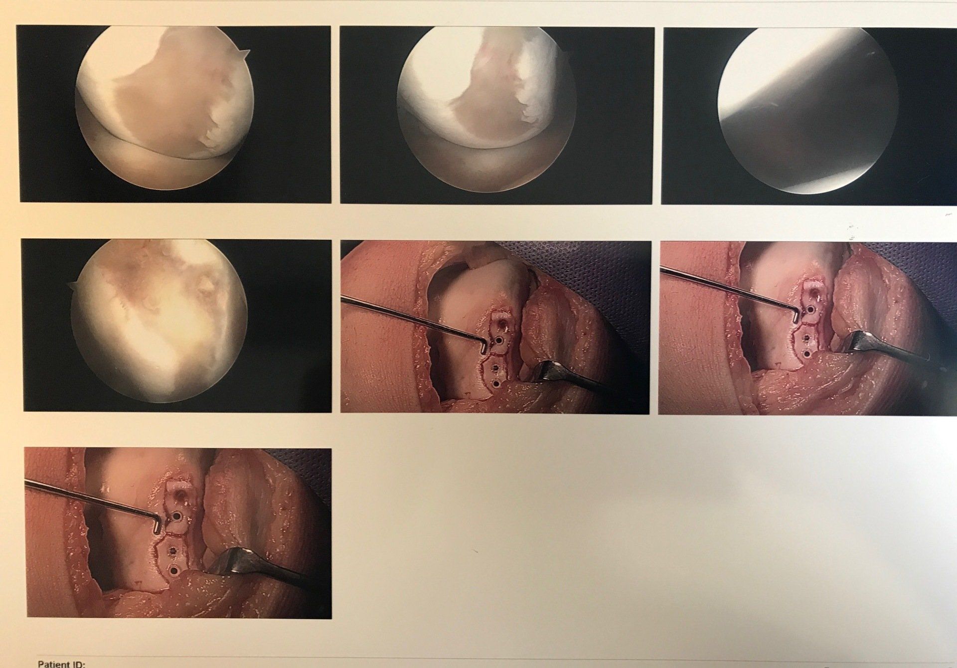 A collage of images of a person 's face with the letters ucsd on the bottom