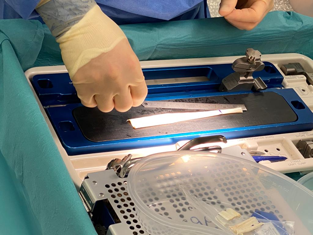 A surgeon is holding a piece of metal in his hand
