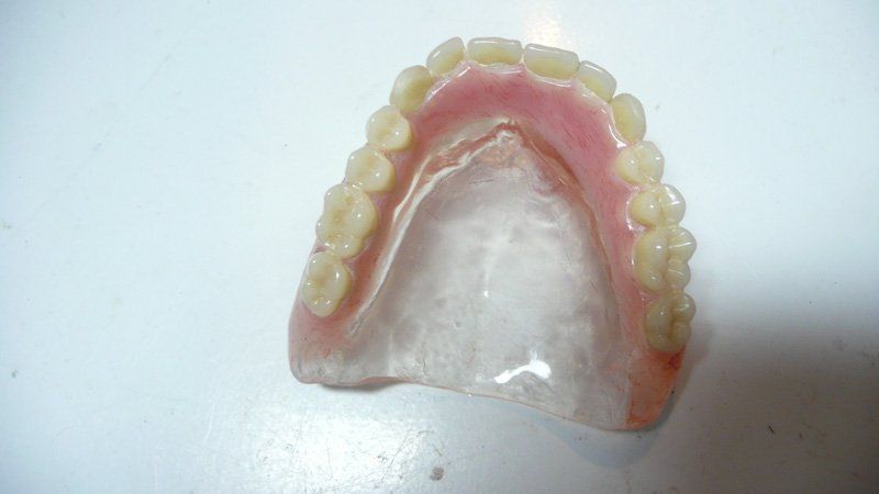 View of a denture