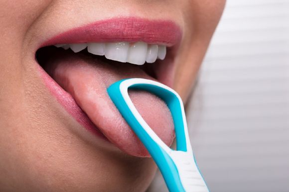 igiene dentale