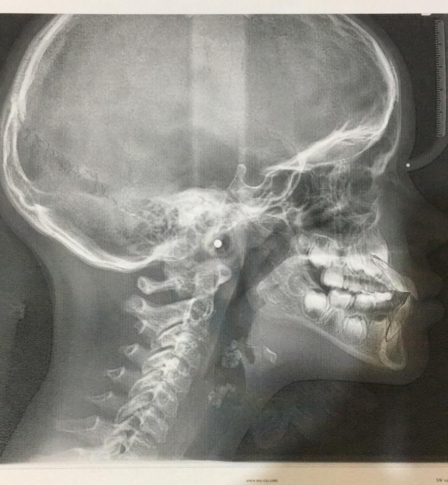 Gnatologia
