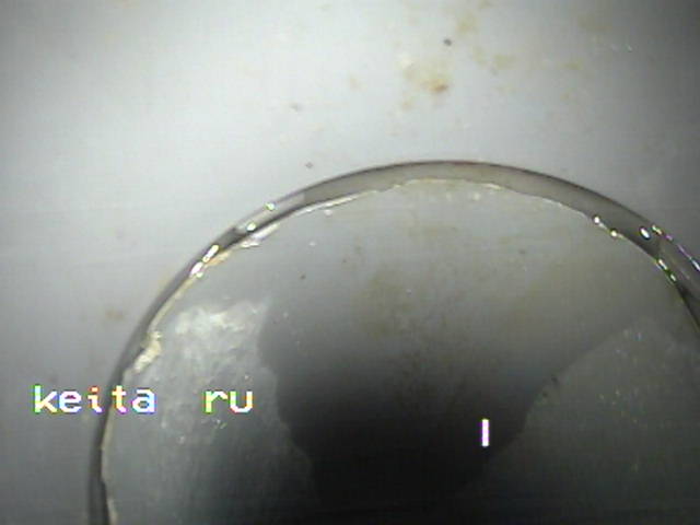 Inspecção visual endoscopia
