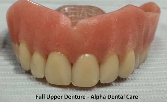 Full Upper Denture - Alpha Dental Care St. Louis