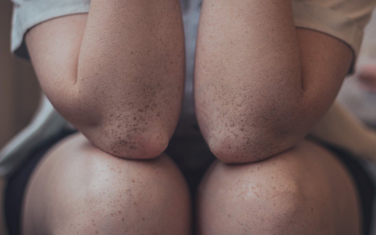 Evolve Medical - Could my weight be affecting my joints?