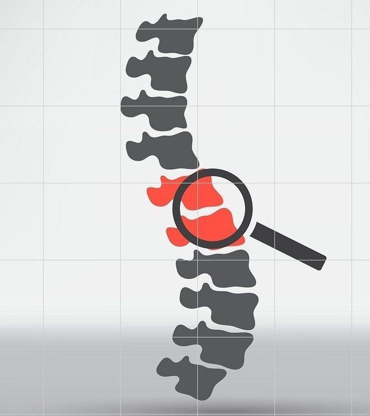 Interesting research on acupuncture