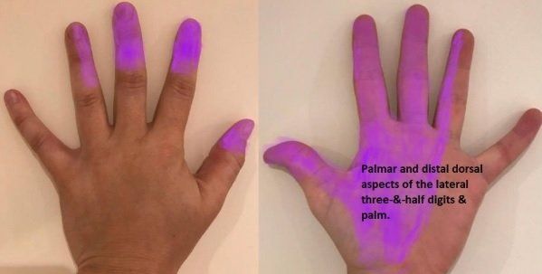 Sensory supply of the median nerve
