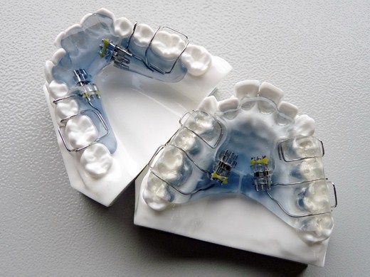 Orofacial Orthopaedic development