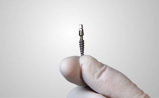 Schonende Behandlung mit minimalinvasiven Implantaten Schonende Behandlung mit minimalinvasiven Implantaten
