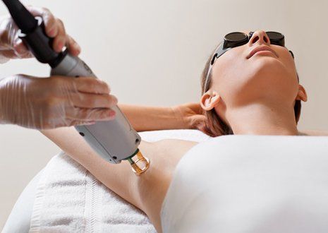 Laser Hair Removal