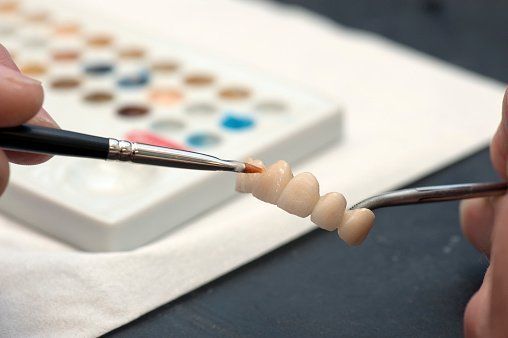 Colorazione di singola protesi