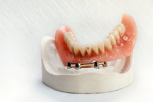 Bambina in visita dal dentista
