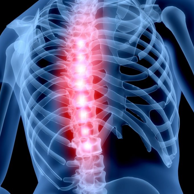 A x-ray of a person 's skeleton with a red spine