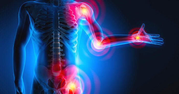 A 3d rendering of a man with joint pain in his arms and legs.