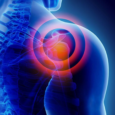 A close up of a person 's shoulder with a red circle around it.