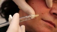laserterapia, acido ialuronico laserterapia, acido ialuronico