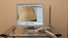 trattamenti laser trattamenti laser