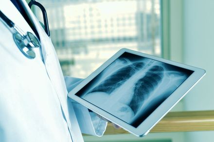 osservazione della radiografia