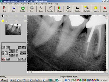 image-369926-Digital_X_Rays-01.jpg?1453335260712