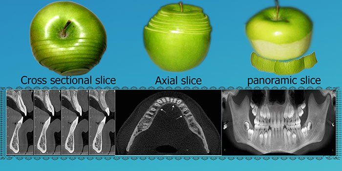 Digital 3D X-Ray Digital 3D X-Ray