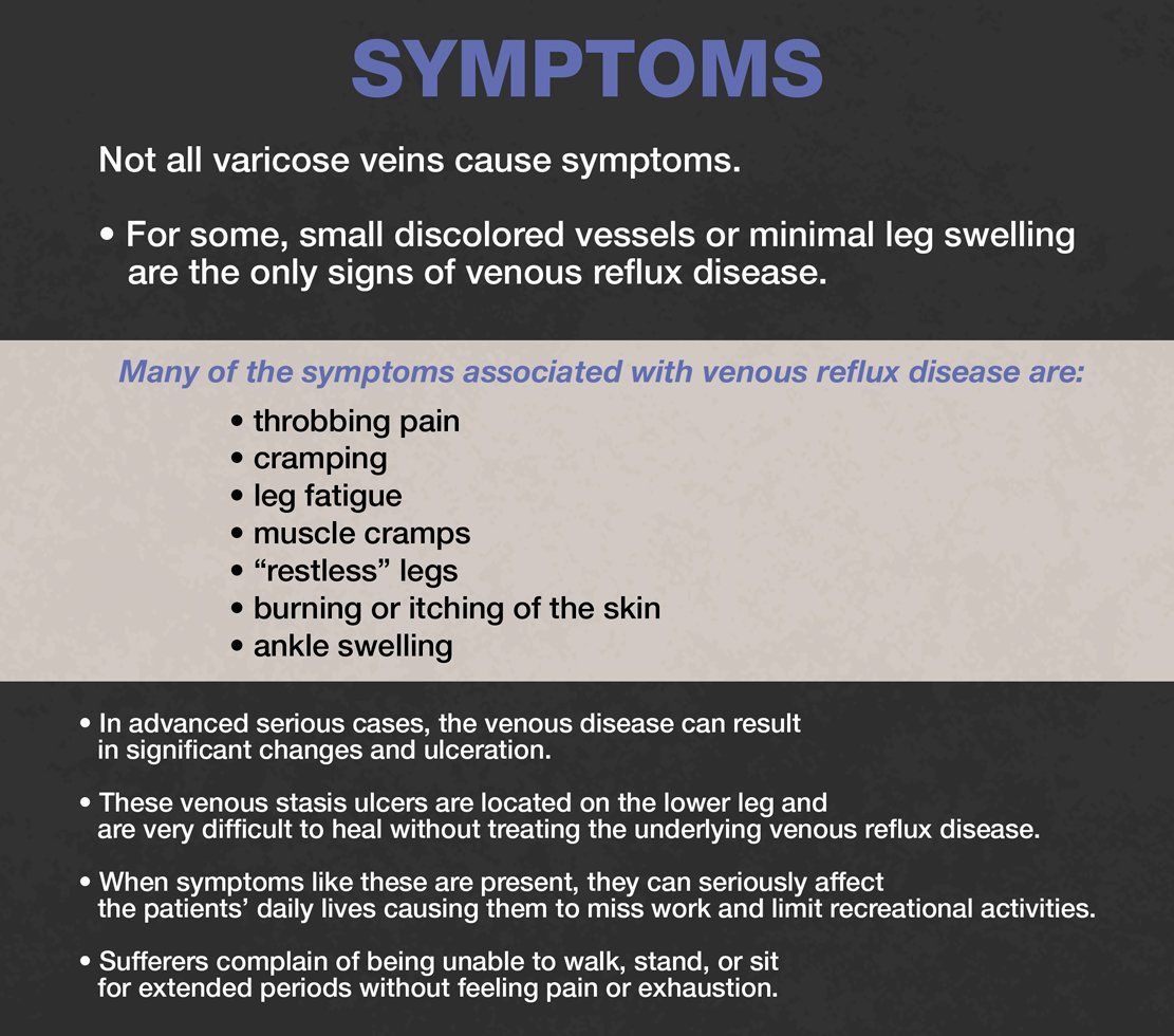 symptoms varicose veins VIRA