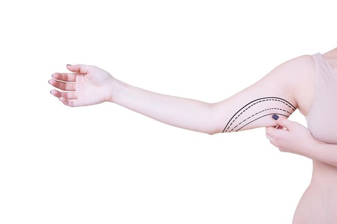 Skin Tightening- Affordable Medical Care in Elmhurst, NY