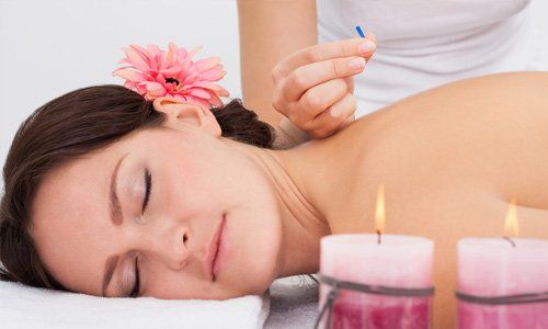 Chinese acupuncture