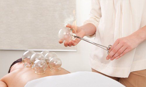 Theory of cupping