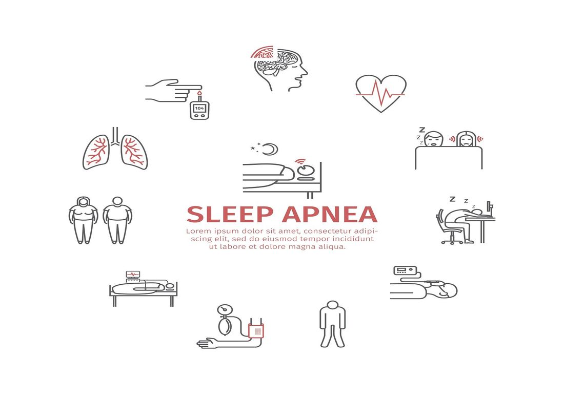grafica apnee notturne