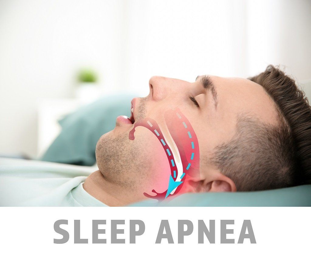 uomo con apnea notturna