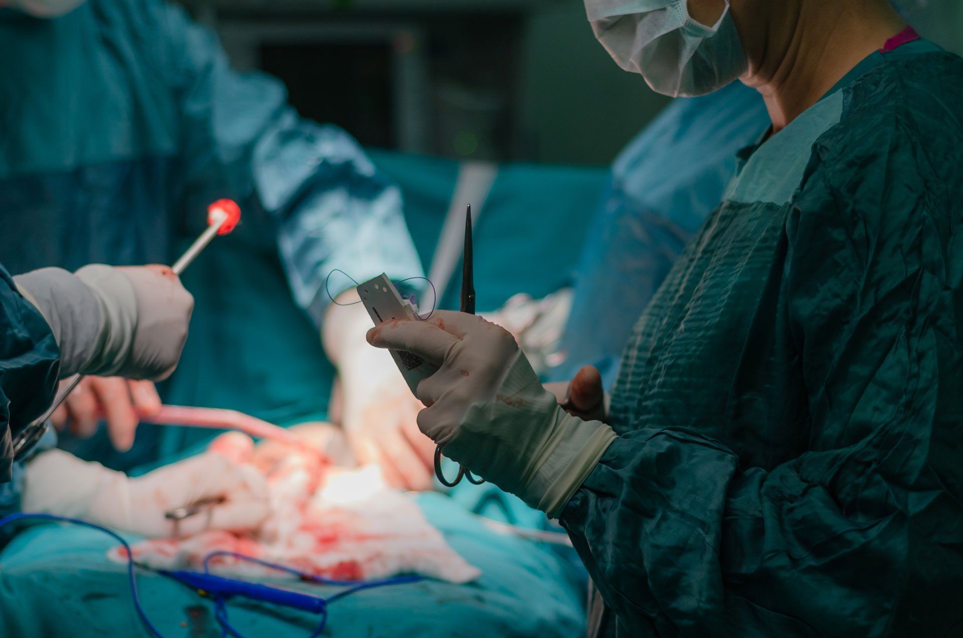 Surgery — Hysterectomy Operation in Manchester, NH Surgery — Hysterectomy Operation in Manchester, NH