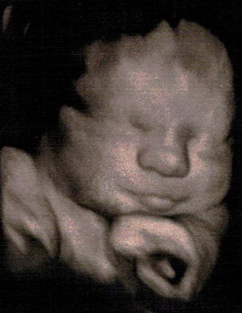 Obgyn — Ultra Sound Services in Manchester, NH Obgyn — Ultra Sound Services in Manchester, NH