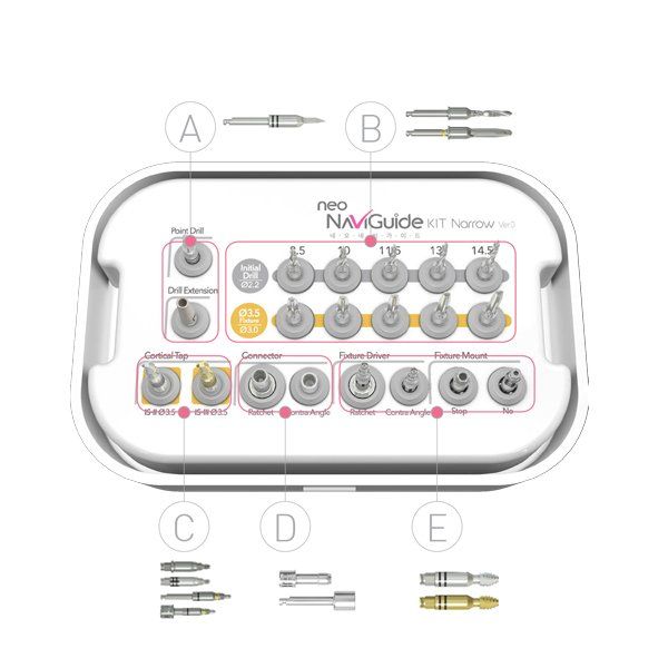 Neo NaviGuide Kit – gidinės implantacijos rinkinys