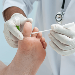 Diabetic foot assessments