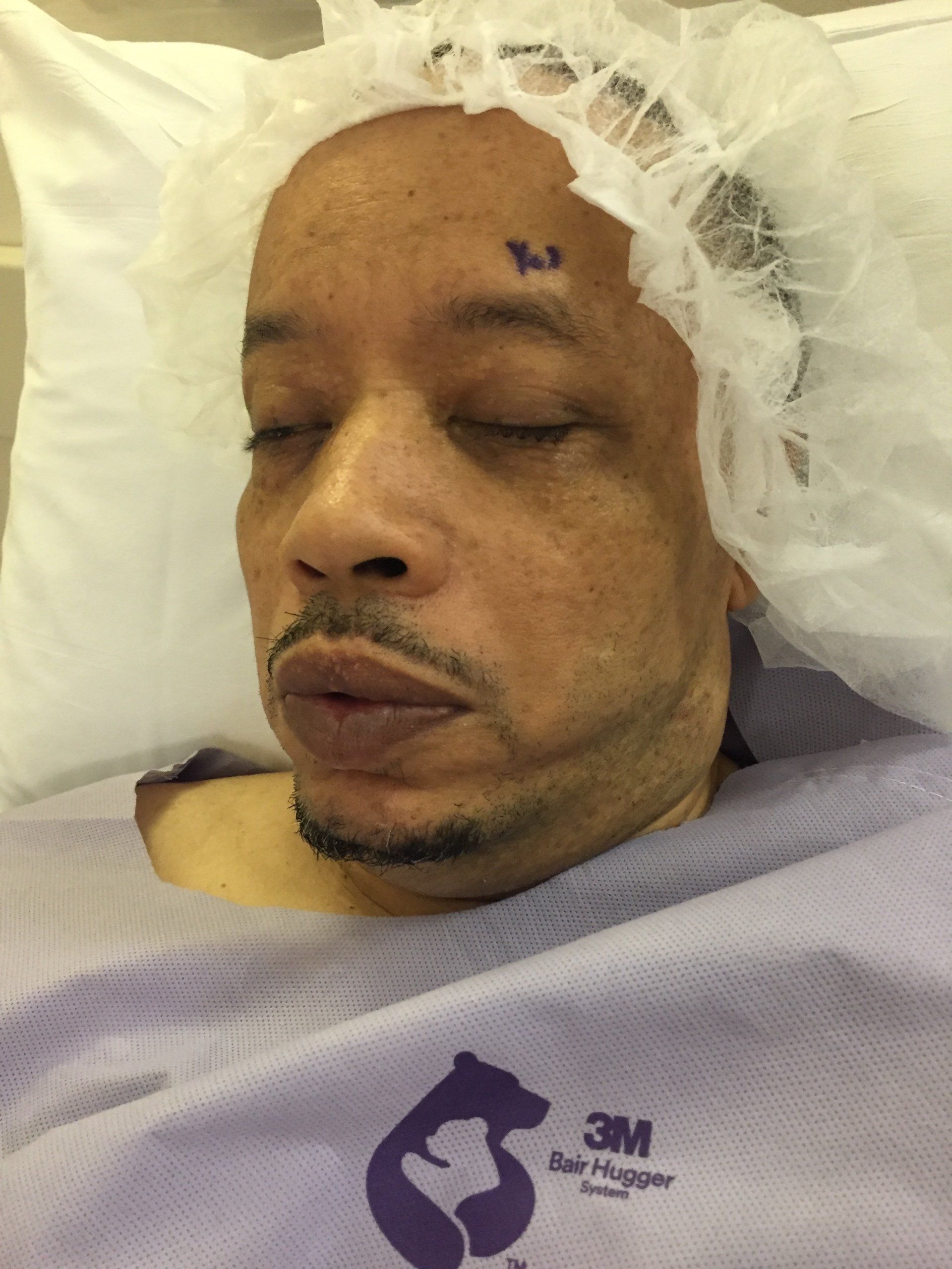 Langford Cunningham in hospital after eye surgery