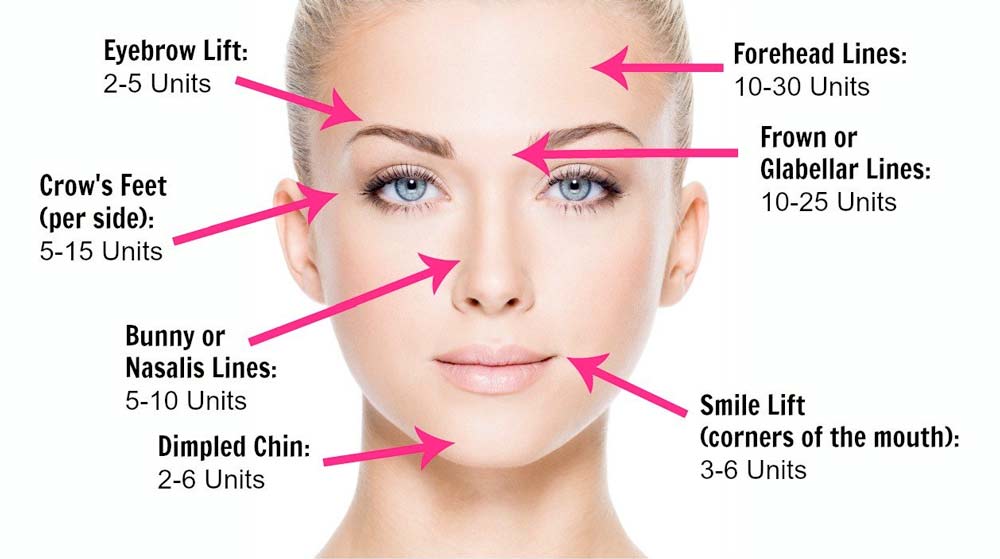 A diagram of a woman 's face with arrows pointing to different areas