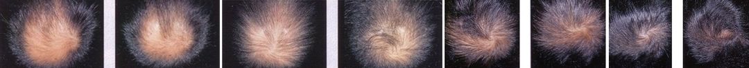 ricrescita dei capelli ricrescita dei capelli