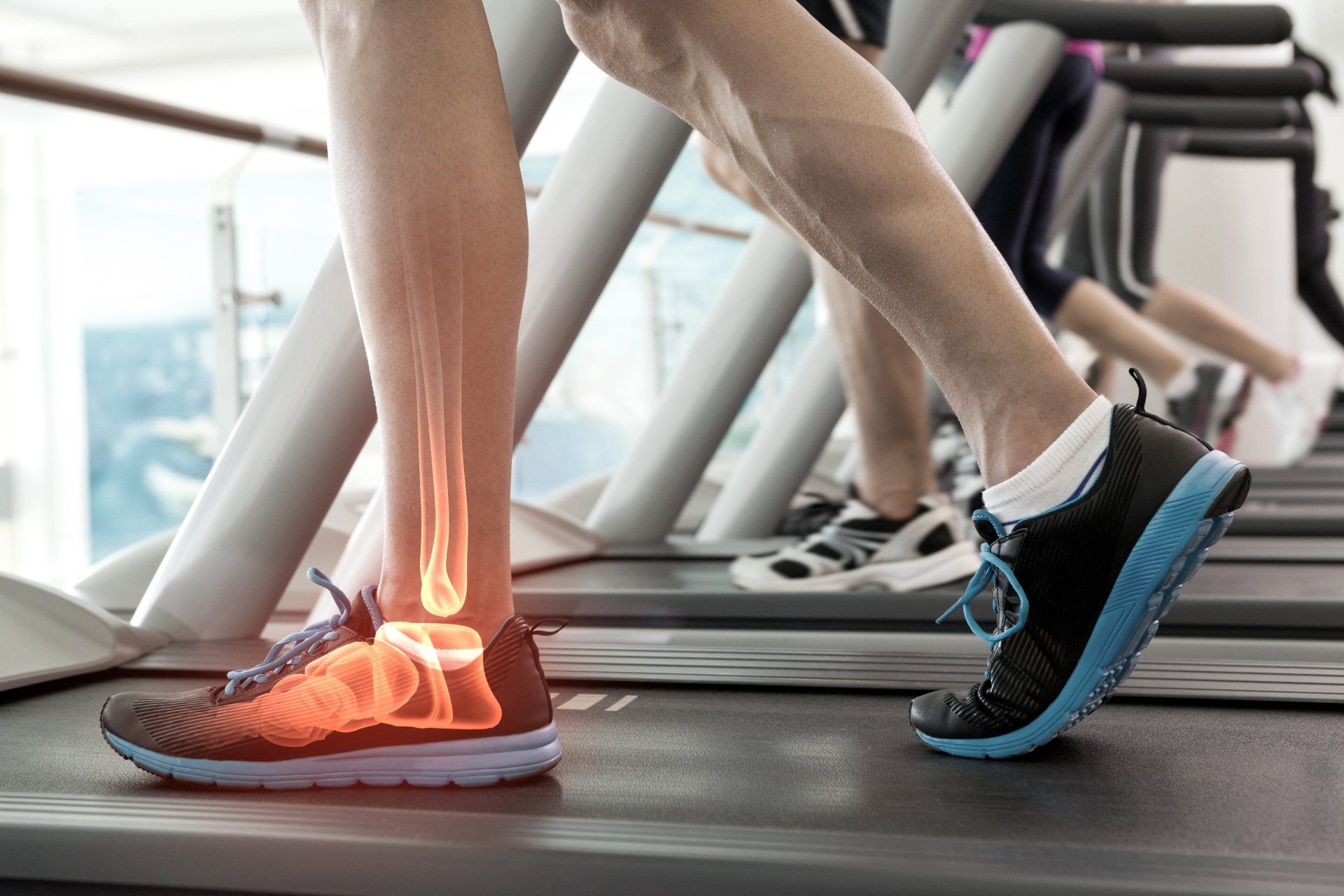 Baton Rouge Foot Doctor for Plantar Fasciitis