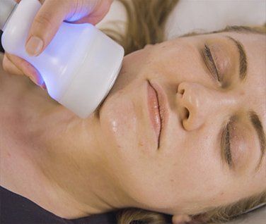 Before and After Image of a Woman After Facial — Solon, OH — Core Elite Wellness Fit Cryo LLC