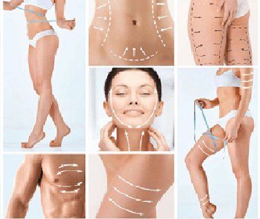 Body of a Woman with Lines — Solon, OH — Core Elite Wellness Fit Cryo LLC