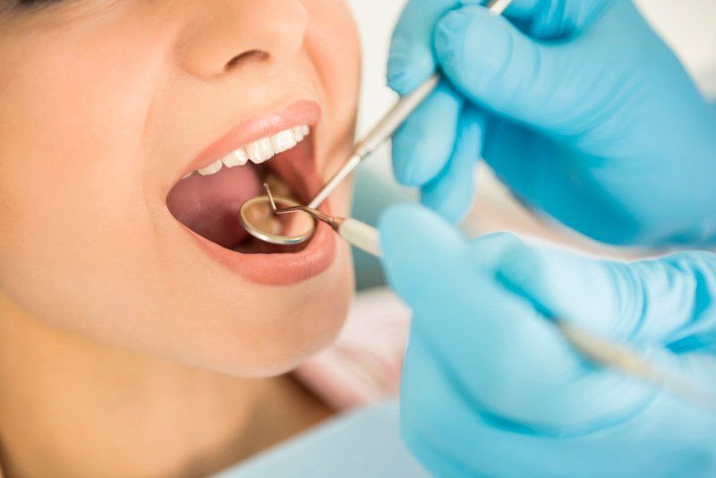 Dental Restorations