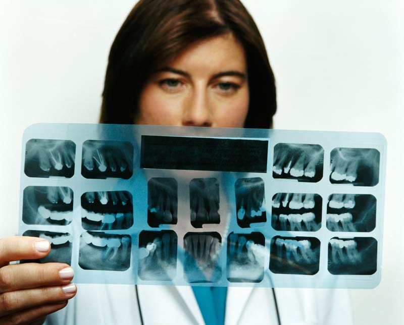 teeth xrays