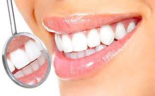 Teeth whitening