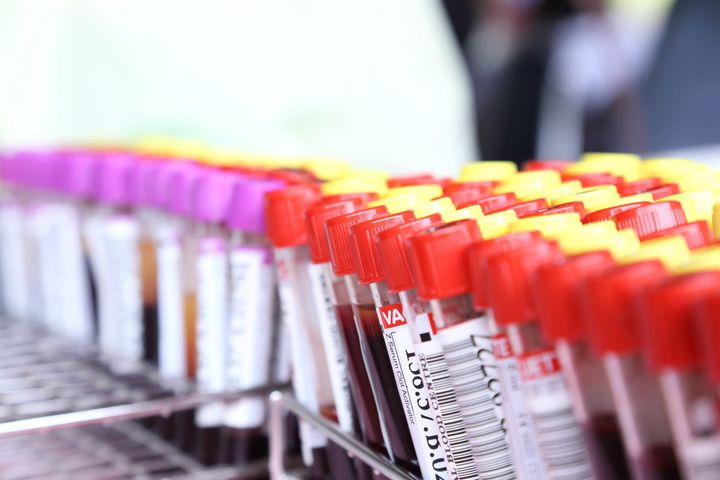 Provette di sangue da analizzare