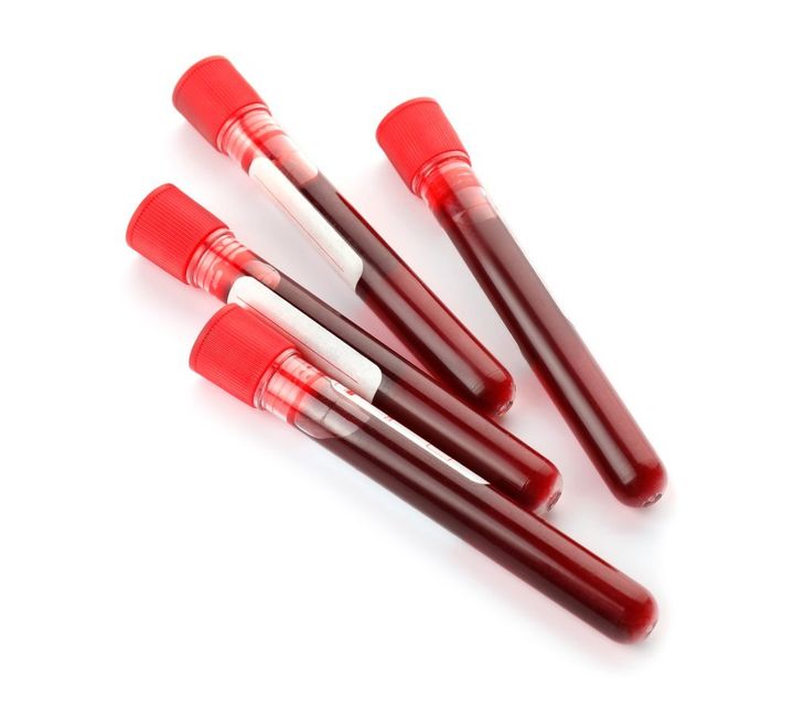 Provette che contengono sangue
