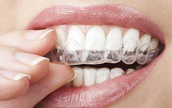 Teeth Whitening Amsterdam, NY