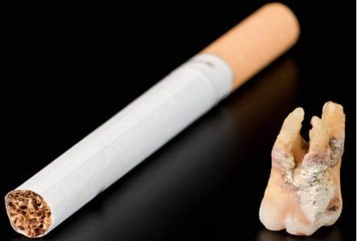 SMOKING EFFECTS ON TEETH